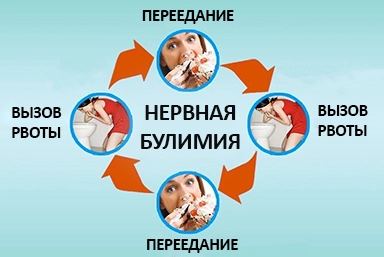 Лечение булимии в Донском